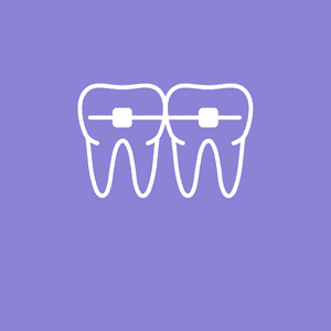 Braces